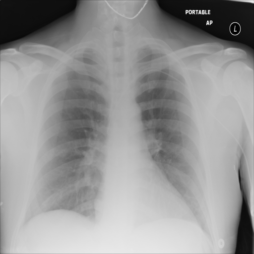 Synthetic radiograph 1