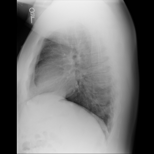 Synthetic radiograph 2